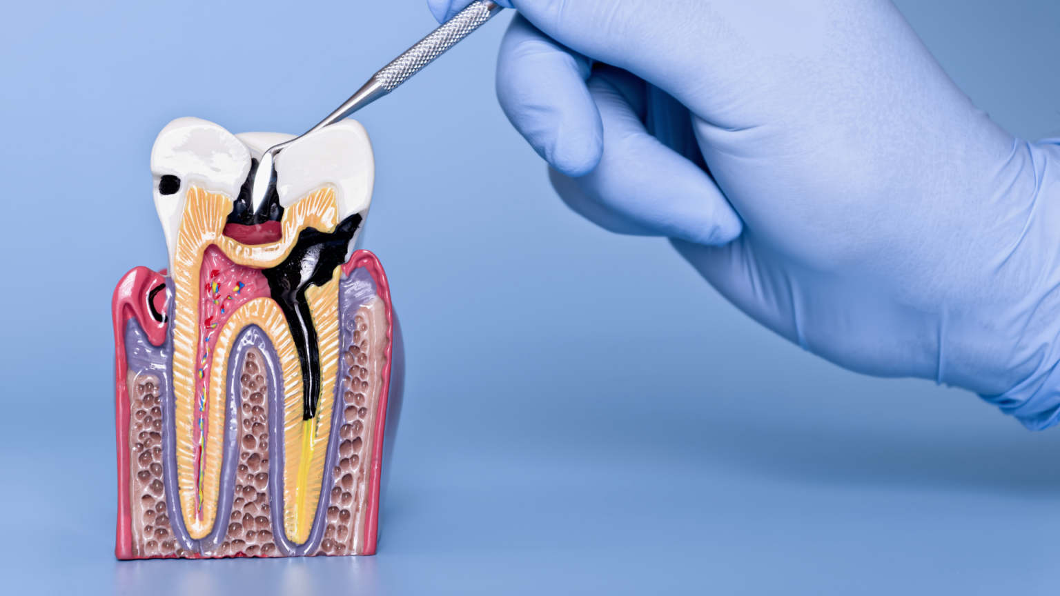 Can Antibiotics Fix a Tooth Infection?