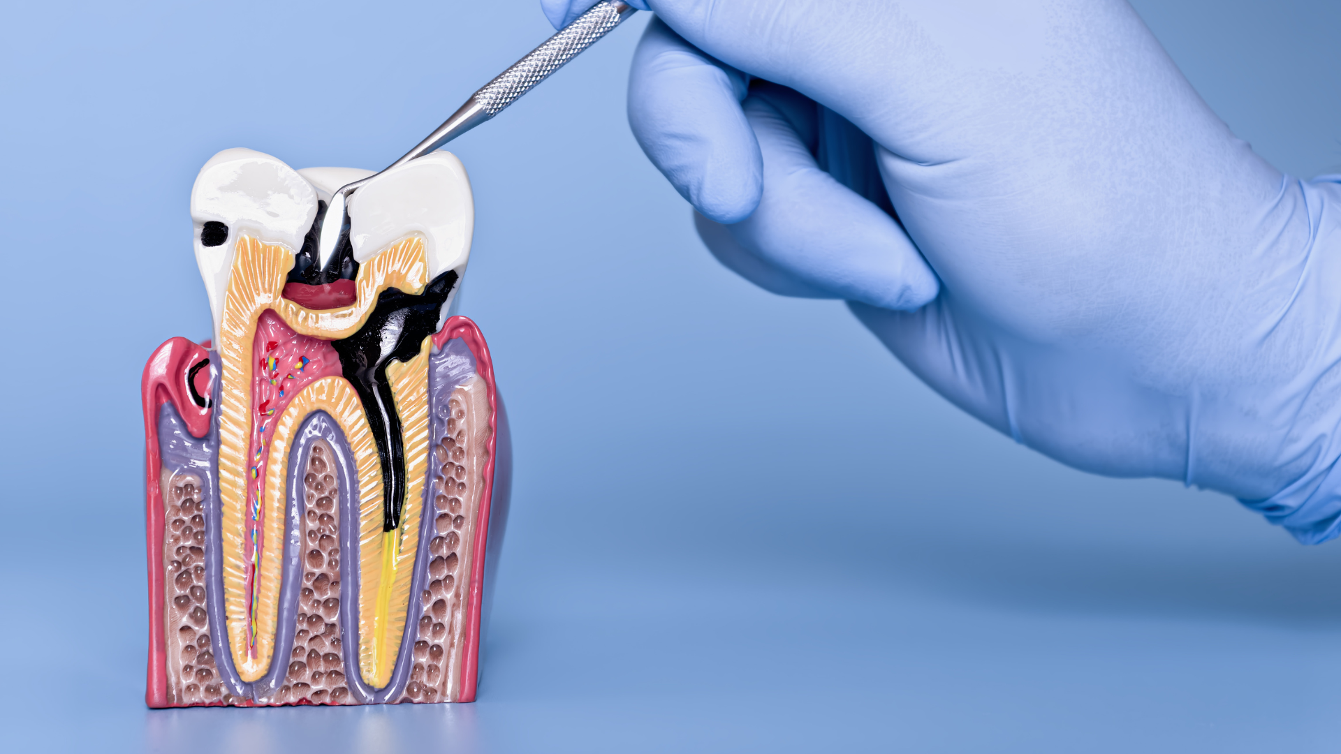 Can Antibiotics Fix a Tooth Infection?