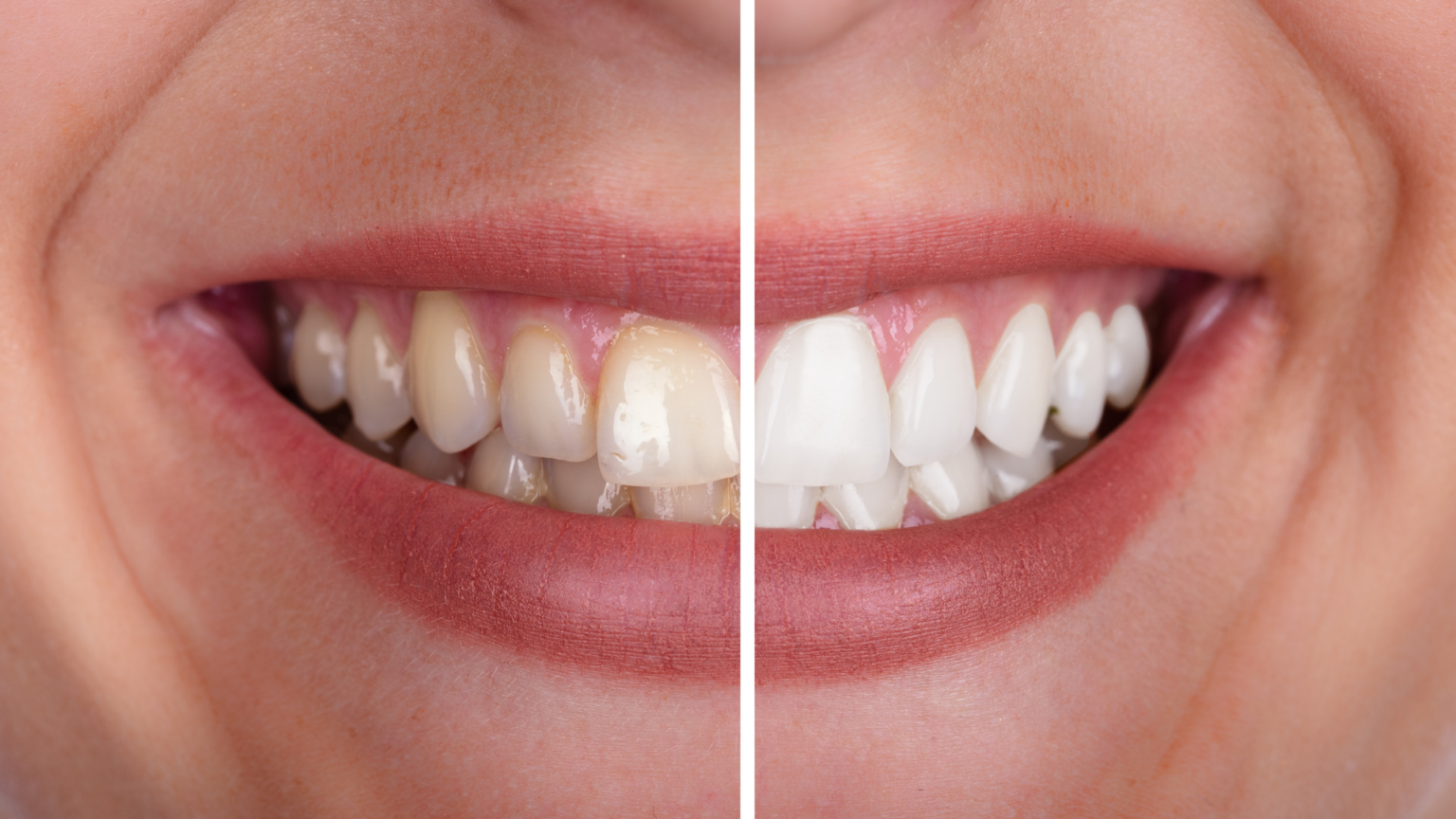 When Should You See a Dentist for Yellow Teeth?